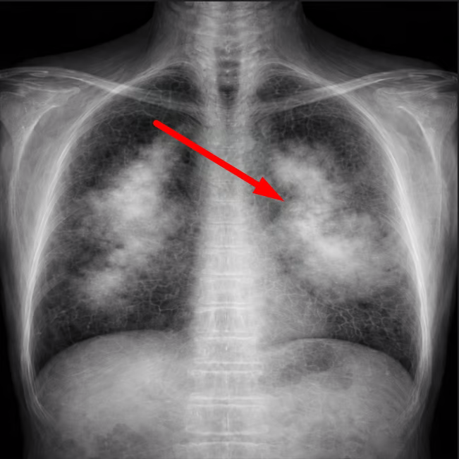 woman with breath difficult